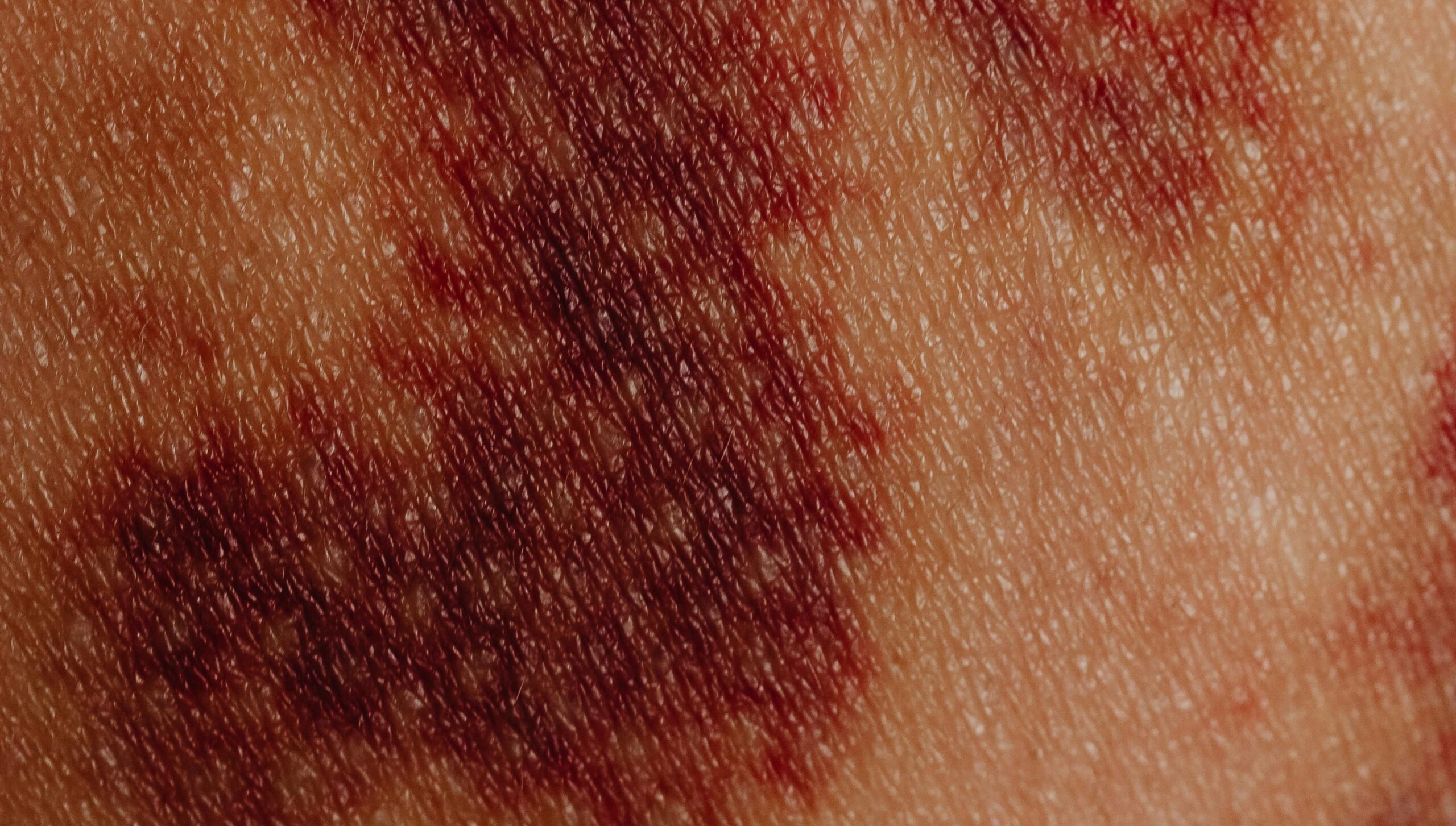 pexels karola g 6643074
